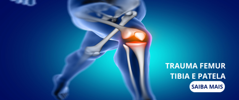 TRAUMA FEMUR TIBIA E PATELA